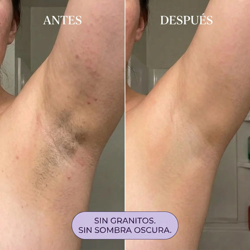 Suavé - Espuma Depilatoria sin Dolor